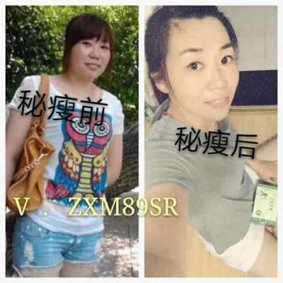 老中医一粒瘦包装