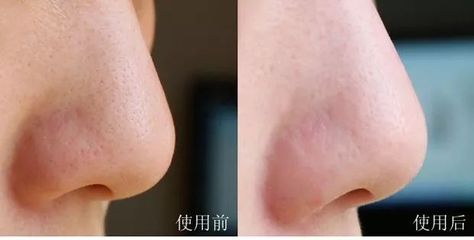 pp霜收缩毛孔吗