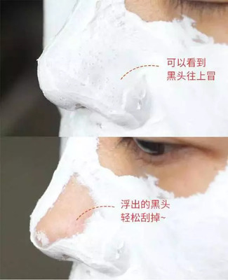 pp霜收缩毛孔吗